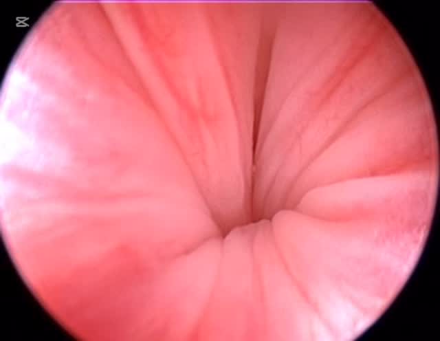 Oncologia: Carcinoma da bexiga em cães
