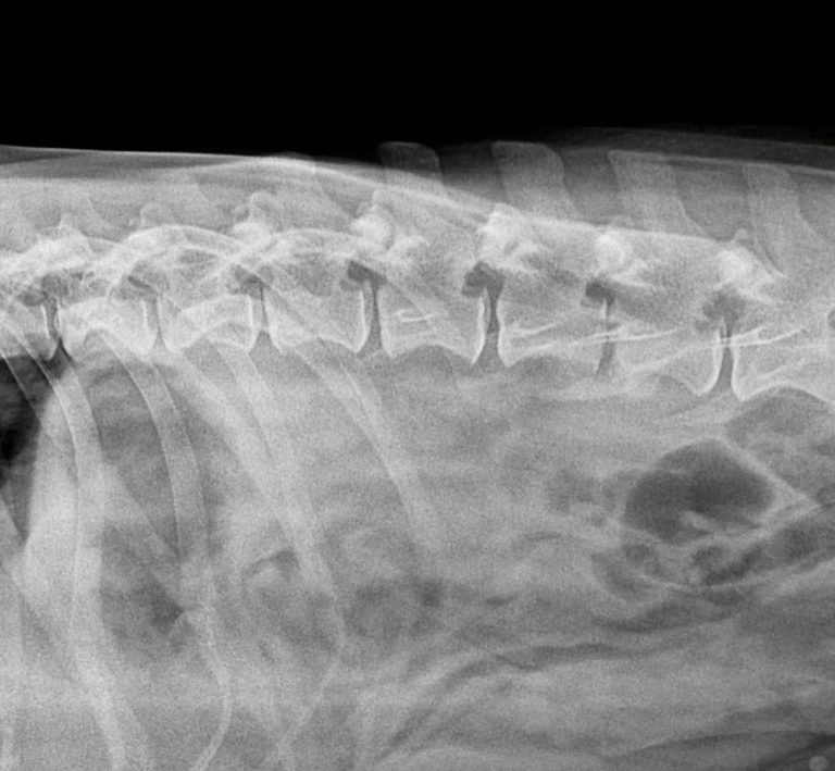 Radiologia: Discoespondilite em radiografia e TAC (imagem 1 de 2)