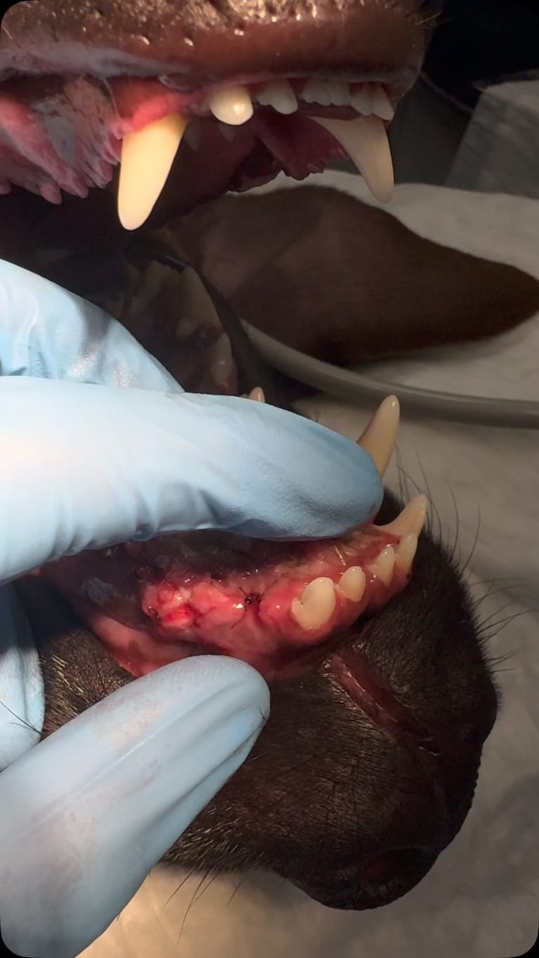 Dentisteria e Odontologia: Traumatismo facial com fratura maxilar