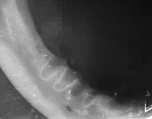 Dentisteria e Odontologia: Ápice migrante em odontologia felina (imagem 3 de 4)