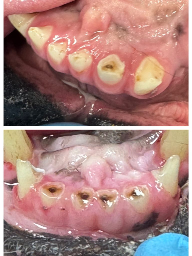 Dentisteria e Odontologia: Incisivos desgastados: nem sempre o óbvio
