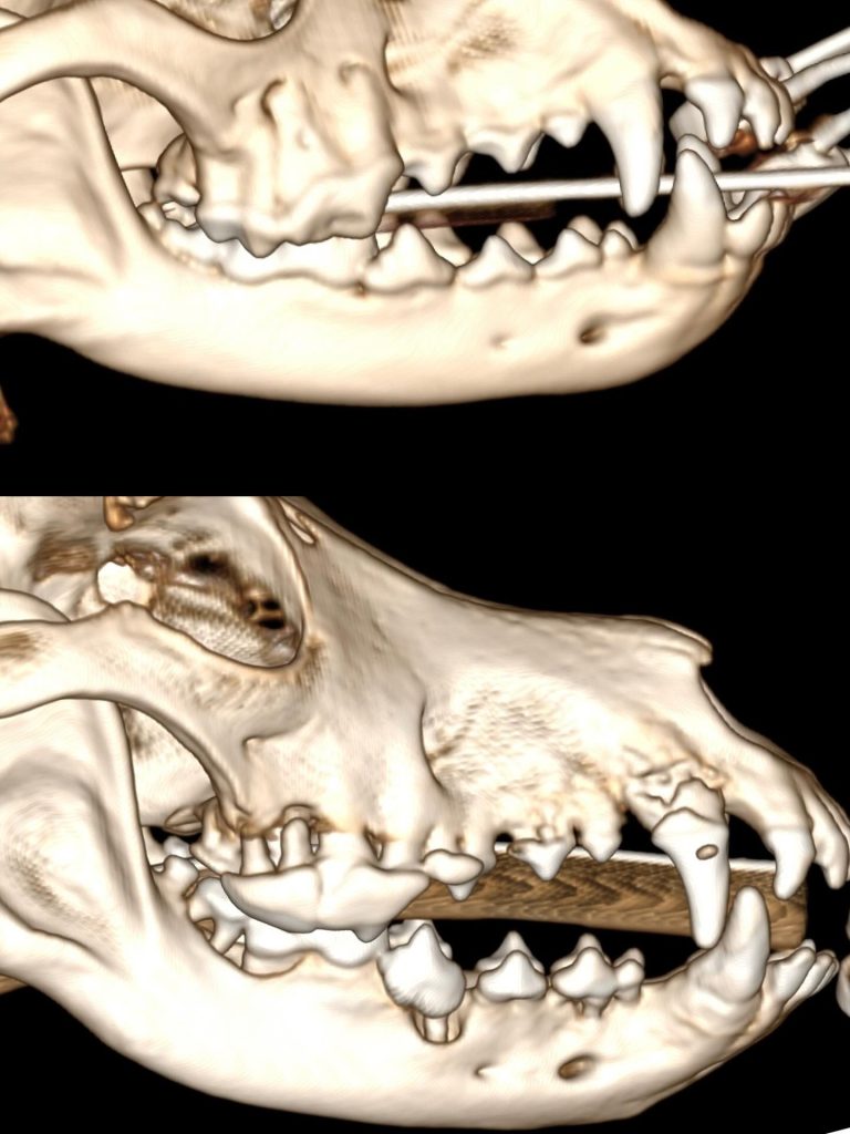 TAC: TC na avaliação da doença periodontal