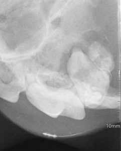 Dentisteria e Odontologia: Radiologia oral na doença periodontal (imagem 2 de 6)