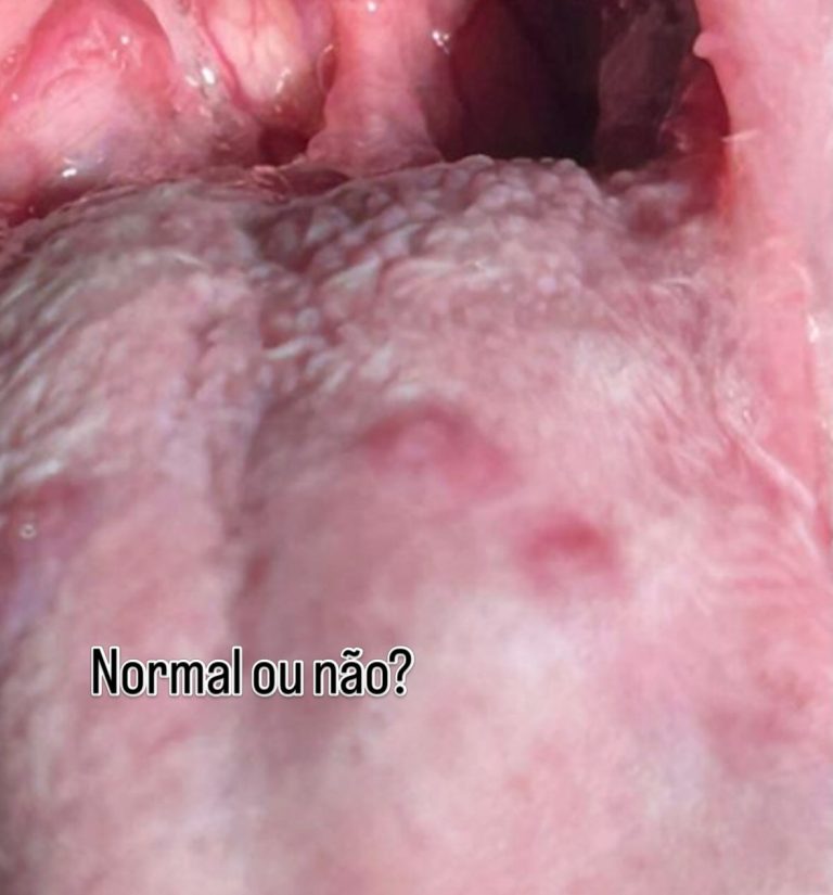 Dentisteria e Odontologia: Mancha na língua do cão: lesão ou anatomia normal? (imagem 1 de 2)
