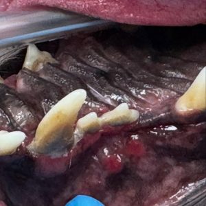 Dentisteria e Odontologia: Ulceração oral por placa mineralizada (imagem 2 de 2)