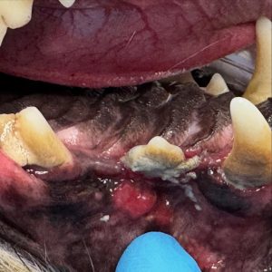 Dentisteria e Odontologia: Ulceração oral por placa mineralizada (imagem 1 de 2)