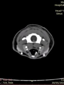 Oncologia: Carcinoma felino com lesão osteolítica invasiva (imagem 4 de 5)