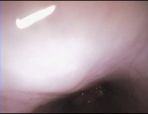 Endoscopia: Massas nasofaríngeas em gatos (imagem 1 de 2)
