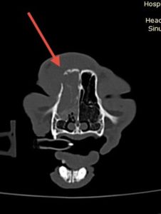 Oncologia: Carcinoma felino com lesão osteolítica invasiva (imagem 3 de 5)