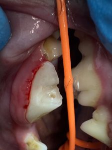 Dentisteria e Odontologia: Fraturas dentárias em cães (imagem 3 de 3)