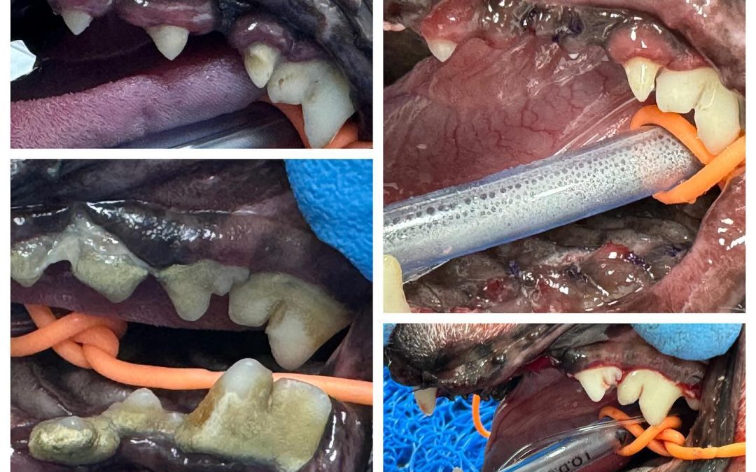 Doença periodontal avançada com exodontias