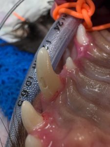 Dentisteria e Odontologia: Fratura dentária por objetos rígidos (imagem 4 de 5)