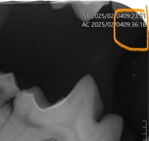 Radiologia: Radiografias intraorais sem atrasar o tratamento (imagem 2 de 2)