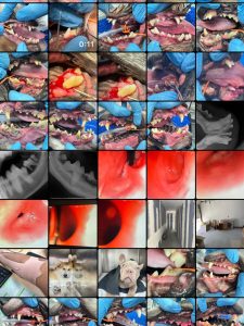 Endoscopia: Endoscopia digestiva em corpo estranho