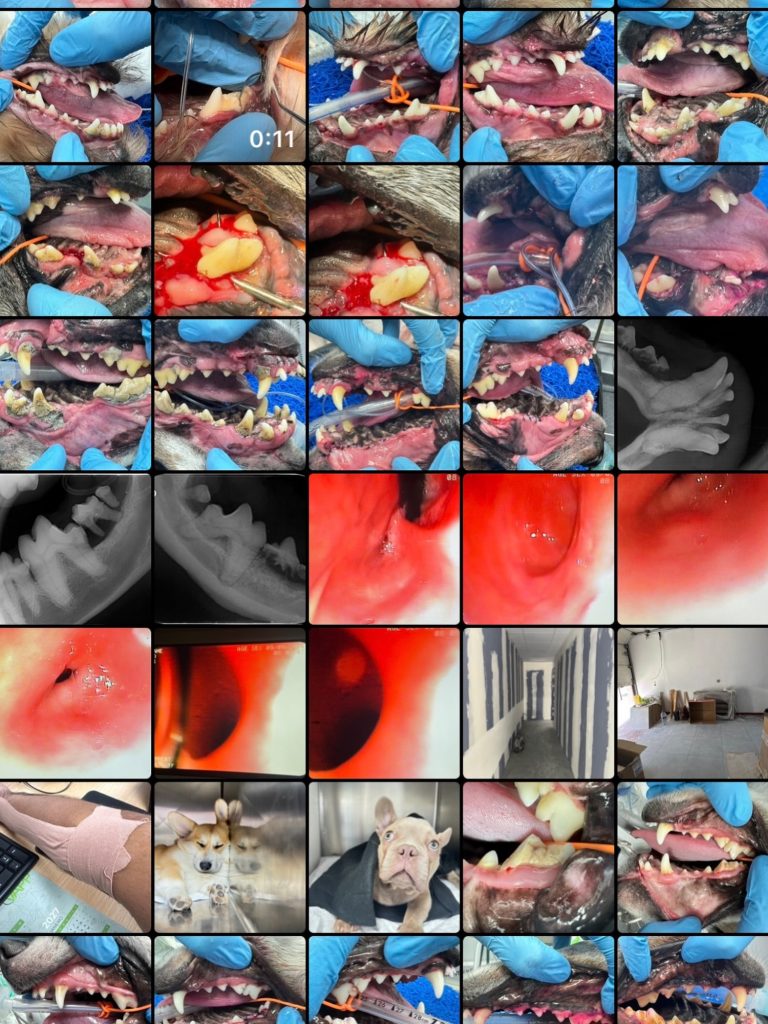 Endoscopia: Endoscopia digestiva em corpo estranho