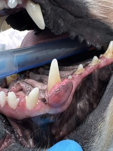 Oncologia: Epúlide ou fibroma odontogénico periférico (imagem 1 de 2)