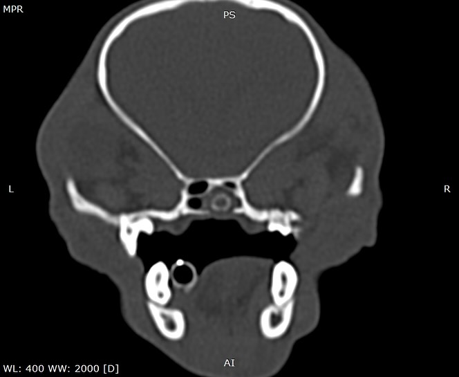 Endoscopia: Corpo estranho na coana em cão jovem (imagem 1 de 2)