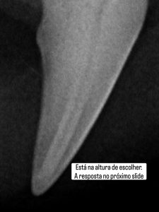 Dentisteria e Odontologia: Reabsorção dentária felina invisível à superfície (imagem 3 de 7)
