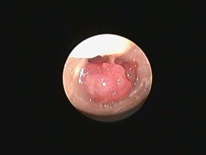 Endoscopia: Otite média em gatos: quando operar (imagem 1 de 3)
