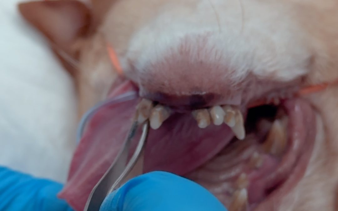 Doença periodontal avançada e extração dentária