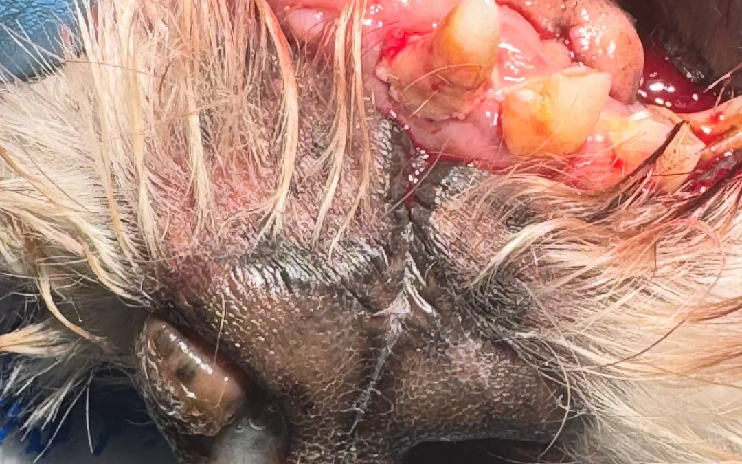 Corrimento nasal com origem dentária