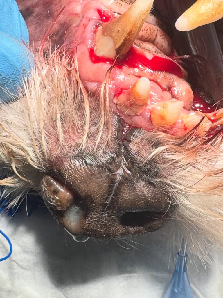 TAC: Corrimento nasal com origem dentária (imagem 1 de 3)