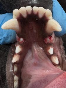Dentisteria e Odontologia: Dentes inclusos jovens e desafio eruptivo (imagem 2 de 2)