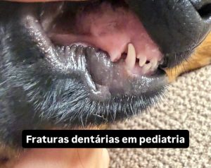 Dentisteria e Odontologia: Fratura dentária em cachorros pediátricos