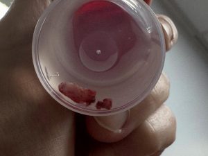 Endoscopia: Otite média em gatos: quando operar (imagem 3 de 3)