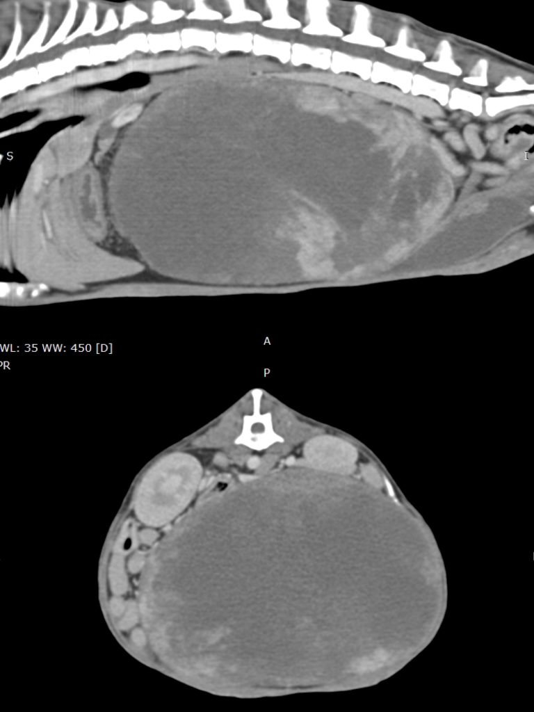 Oncologia: Massa uterina gigante em paciente geriátrica (imagem 1 de 2)