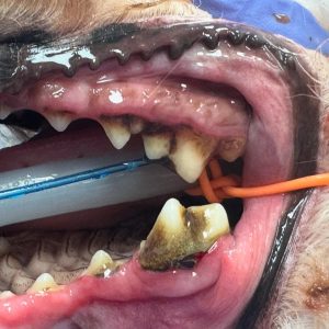 Dentisteria e Odontologia: Extração fechada do quarto pré-molar maxilar (imagem 1 de 2)