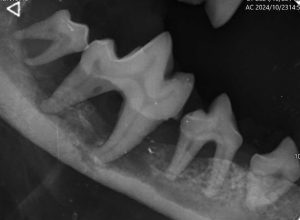 Dentisteria e Odontologia: Doença periodontal terminal em caso extremo (imagem 1 de 9)