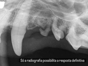 Dentisteria e Odontologia: Radiografias intra-orais no diagnóstico dentário (imagem 2 de 4)