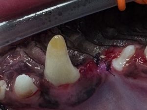 Dentisteria e Odontologia: Dente escurecido nem sempre está morto (imagem 2 de 2)