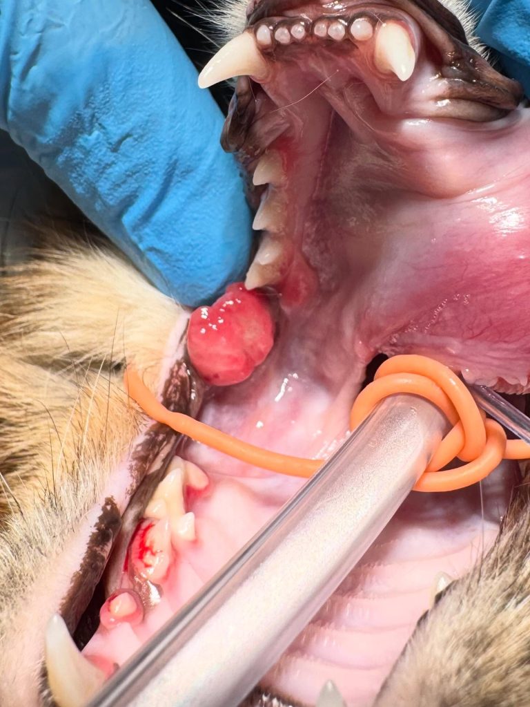 Oncologia: Granulomas piogénicos que parecem massas