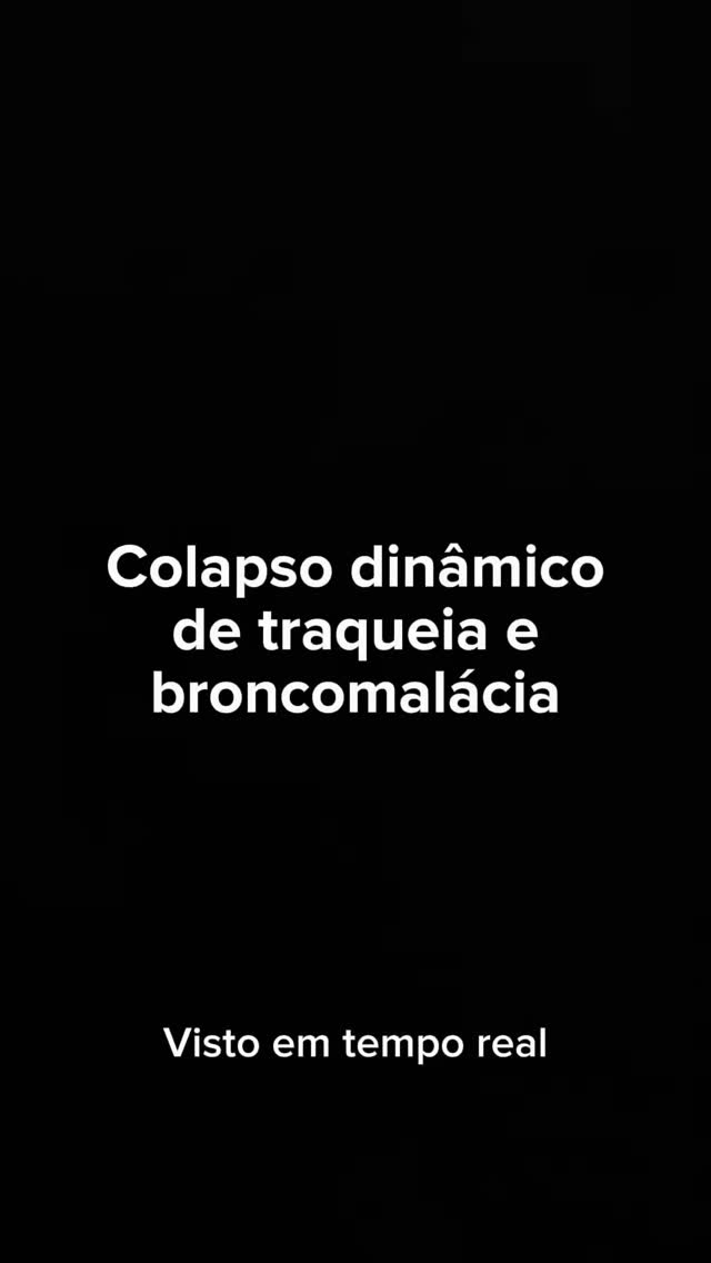 Endoscopia: Colapso de traqueia e broncomalacia em cães