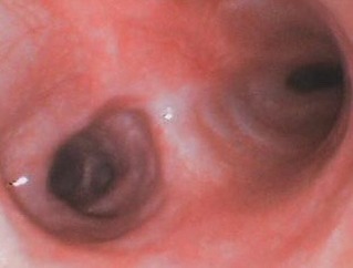 Endoscopia: Colapso brônquico em cães (imagem 1 de 3)
