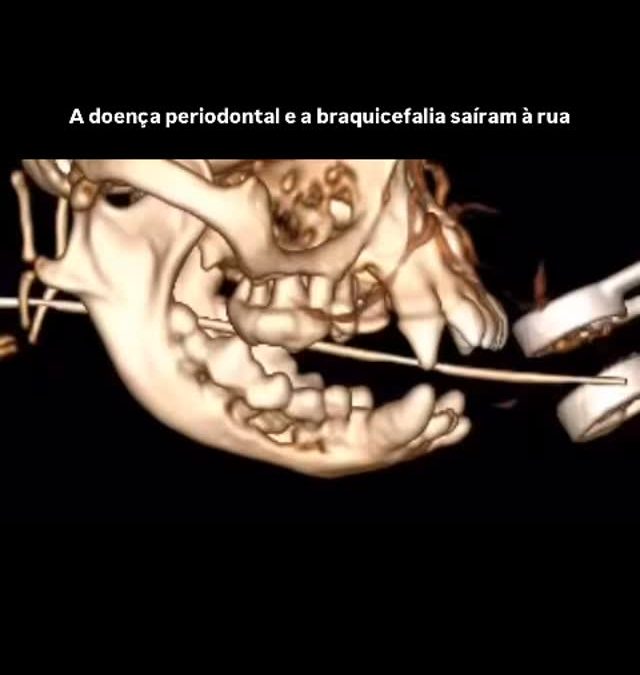 Doença periodontal severa em cães