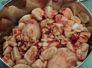 Medicina Interna: Cálculos na bexiga: como se formam (imagem 2 de 2)